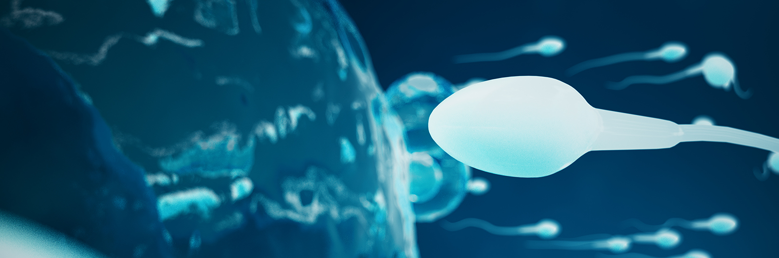 Intracytoplasmic Sperm Injection