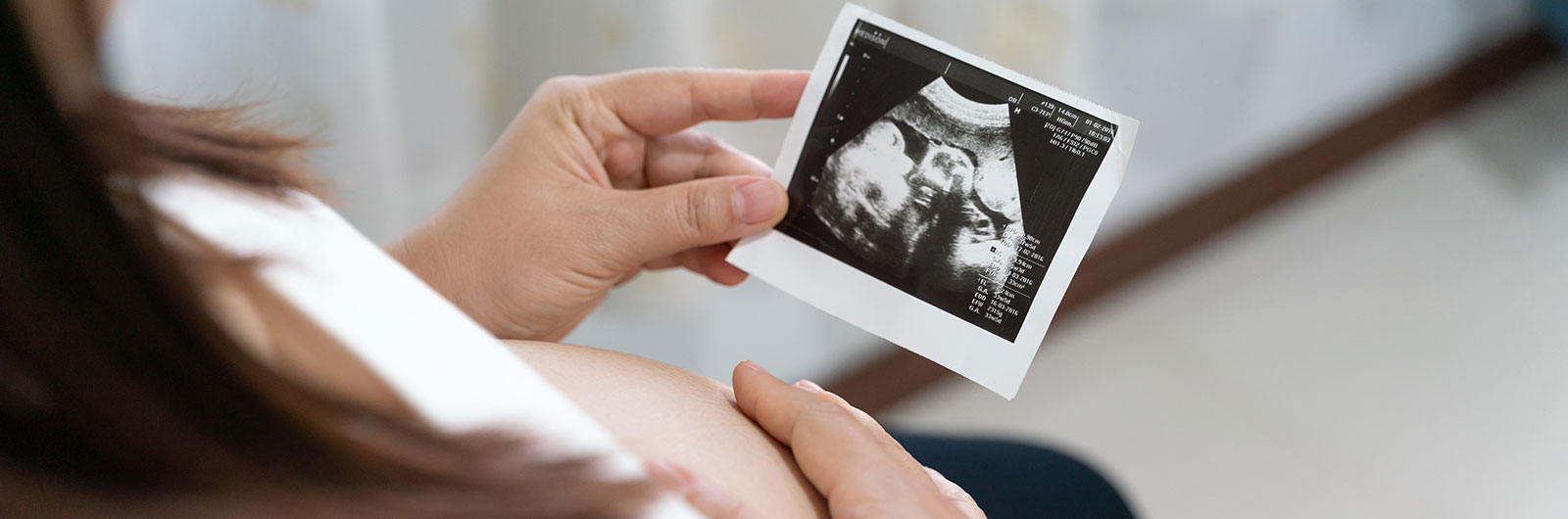 Top Infertility Specialist In Siliguri For Fertility-Related Conditions